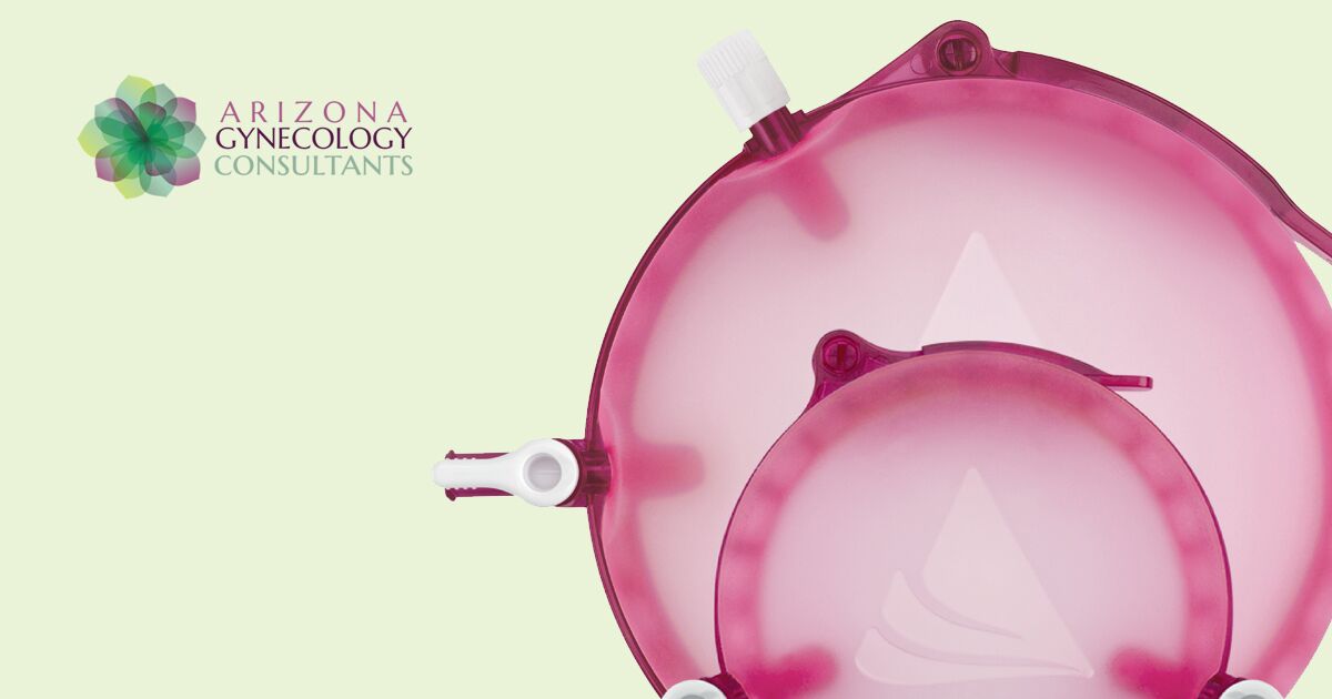 A Guide to Hysterectomy and vNOTES for Arizona Patients
