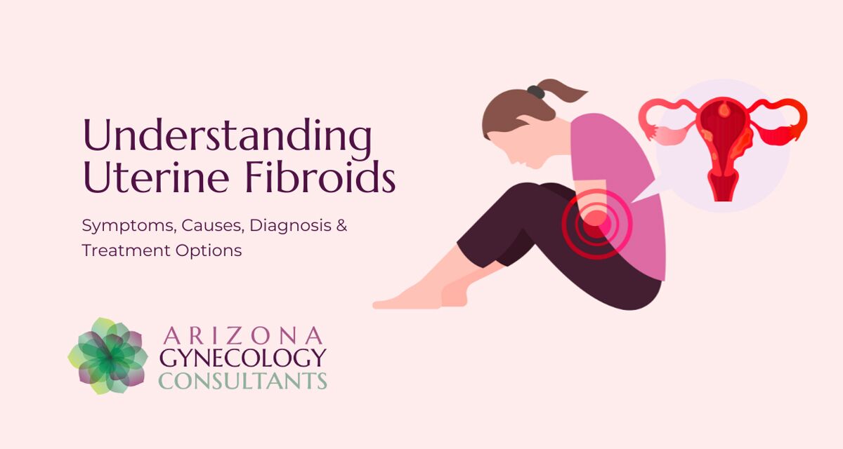 Understanding Uterine Fibroids